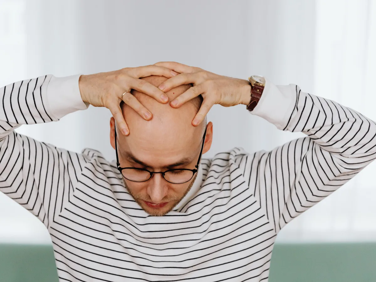 A man holding his hands on his head, worried about his thinning hair.