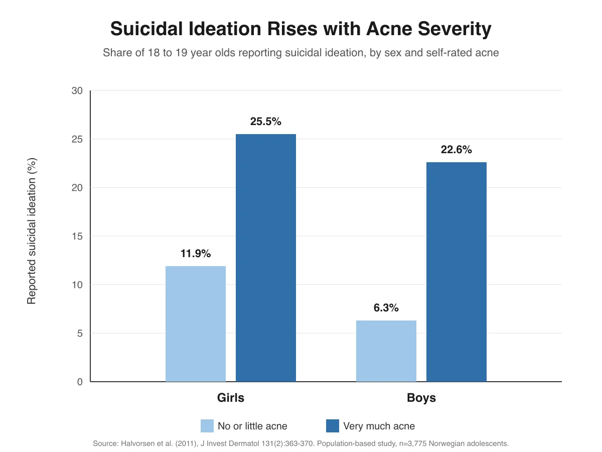 Grouped bar chart showing suicidal ideation rates among Norwegian adolescents by sex and acne severity. Girls with very much acne report 25.5 percent versus 11.9 percent with no or little acne, and boys report 22.6 percent versus 6.3 percent.
